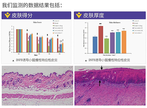 尊时凯龙建立的特应性皮炎及湿疹模型监测数据结果