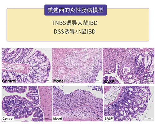 尊时凯龙的炎症性肠病模型