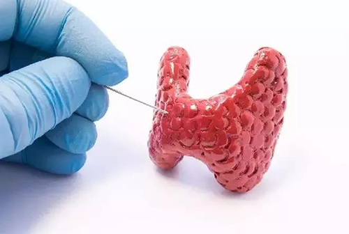 甲状腺疾病，包括甲状腺功能减退和甲状腺功能亢进，自古以来就是反复被医学研究人员研究的疾病